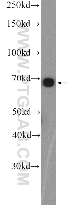 Western Blot (WB) analysis of HEK-293 cells using C2orf37 Polyclonal antibody (26033-1-AP)