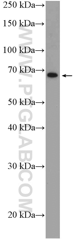 Western Blot (WB) analysis of HL-60 cells using C2orf37 Polyclonal antibody (26033-1-AP)