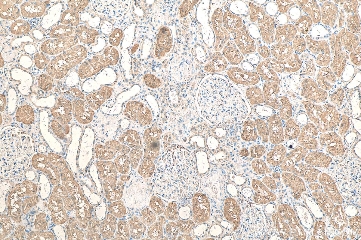 Immunohistochemistry (IHC) staining of human kidney tissue using C2orf47 Polyclonal antibody (24930-1-AP)