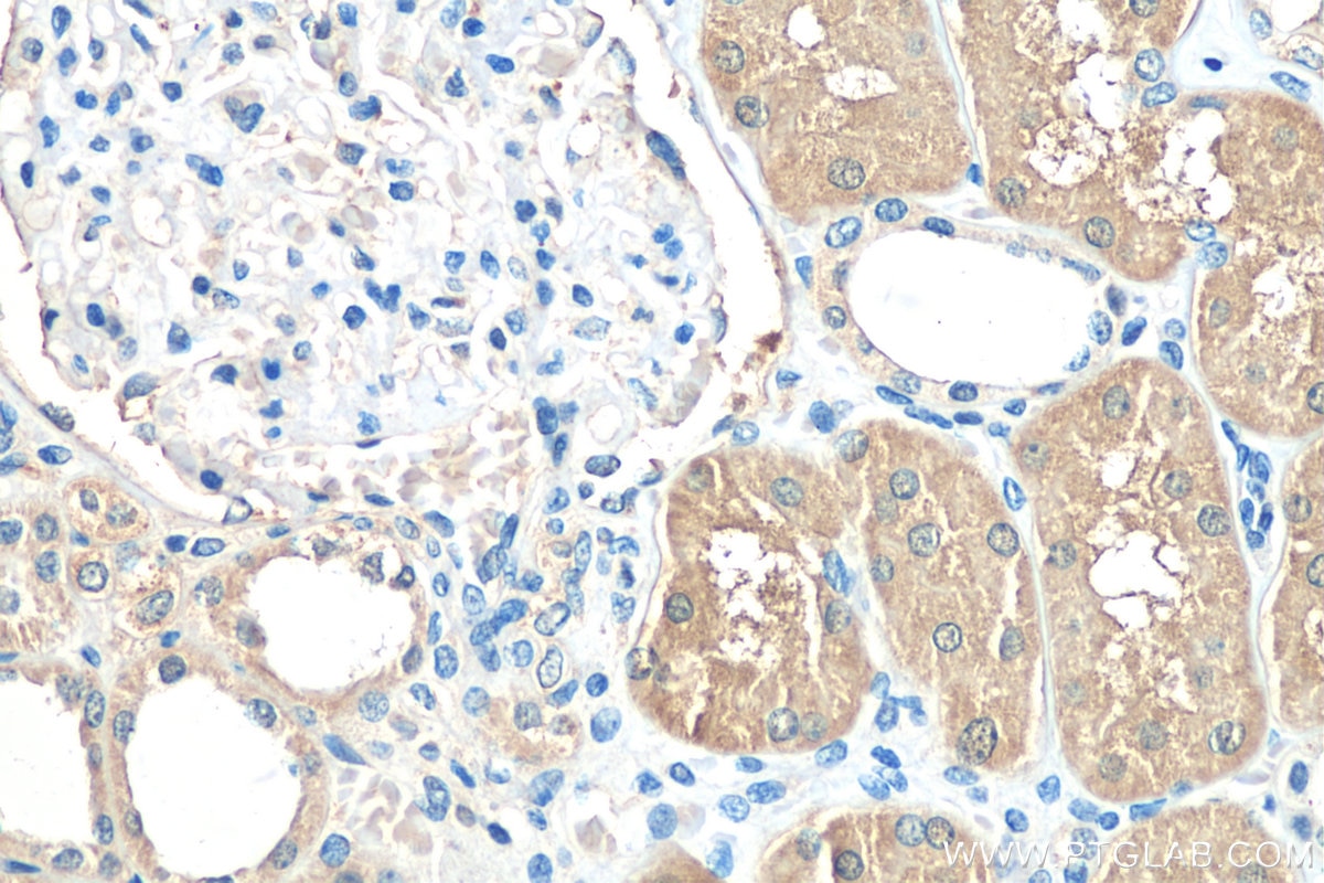 Immunohistochemistry (IHC) staining of human kidney tissue using C2orf47 Polyclonal antibody (24930-1-AP)