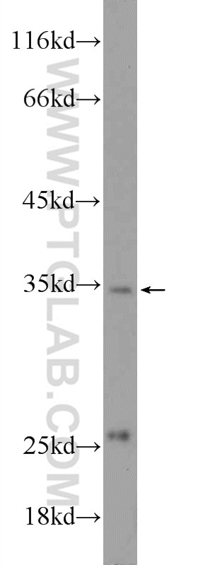 Western Blot (WB) analysis of PC-3 cells using C2orf47 Polyclonal antibody (24930-1-AP)