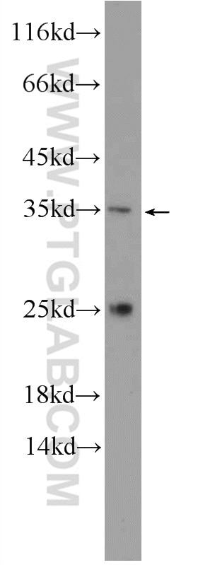 Western Blot (WB) analysis of HeLa cells using C2orf47 Polyclonal antibody (24930-1-AP)