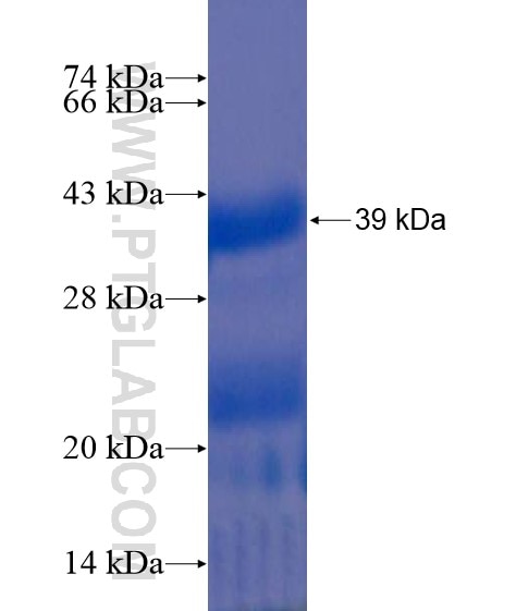 C2orf47 fusion protein Ag21518 SDS-PAGE