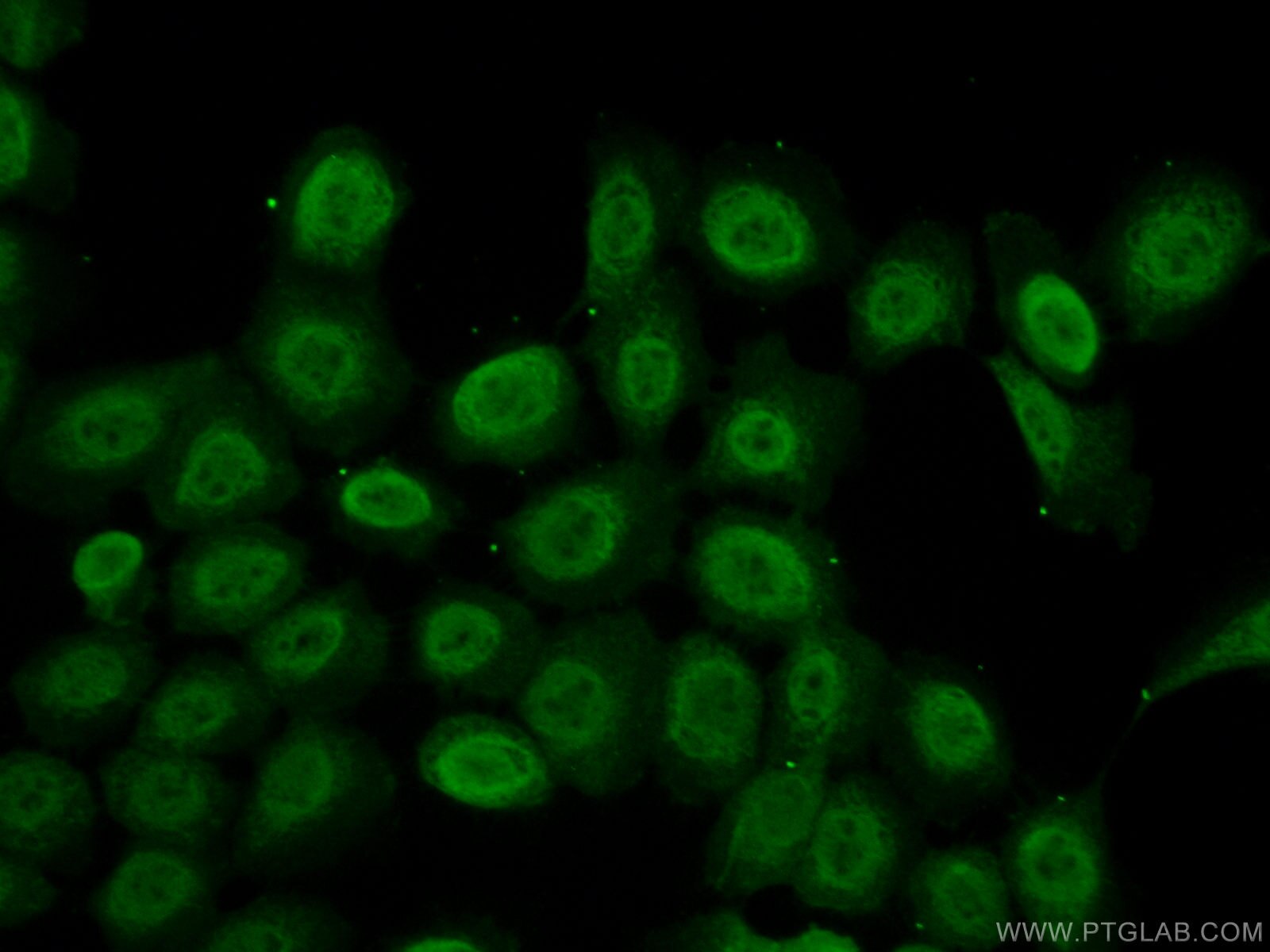 Immunofluorescence (IF) / fluorescent staining of A431 cells using C2orf49 Polyclonal antibody (18272-1-AP)