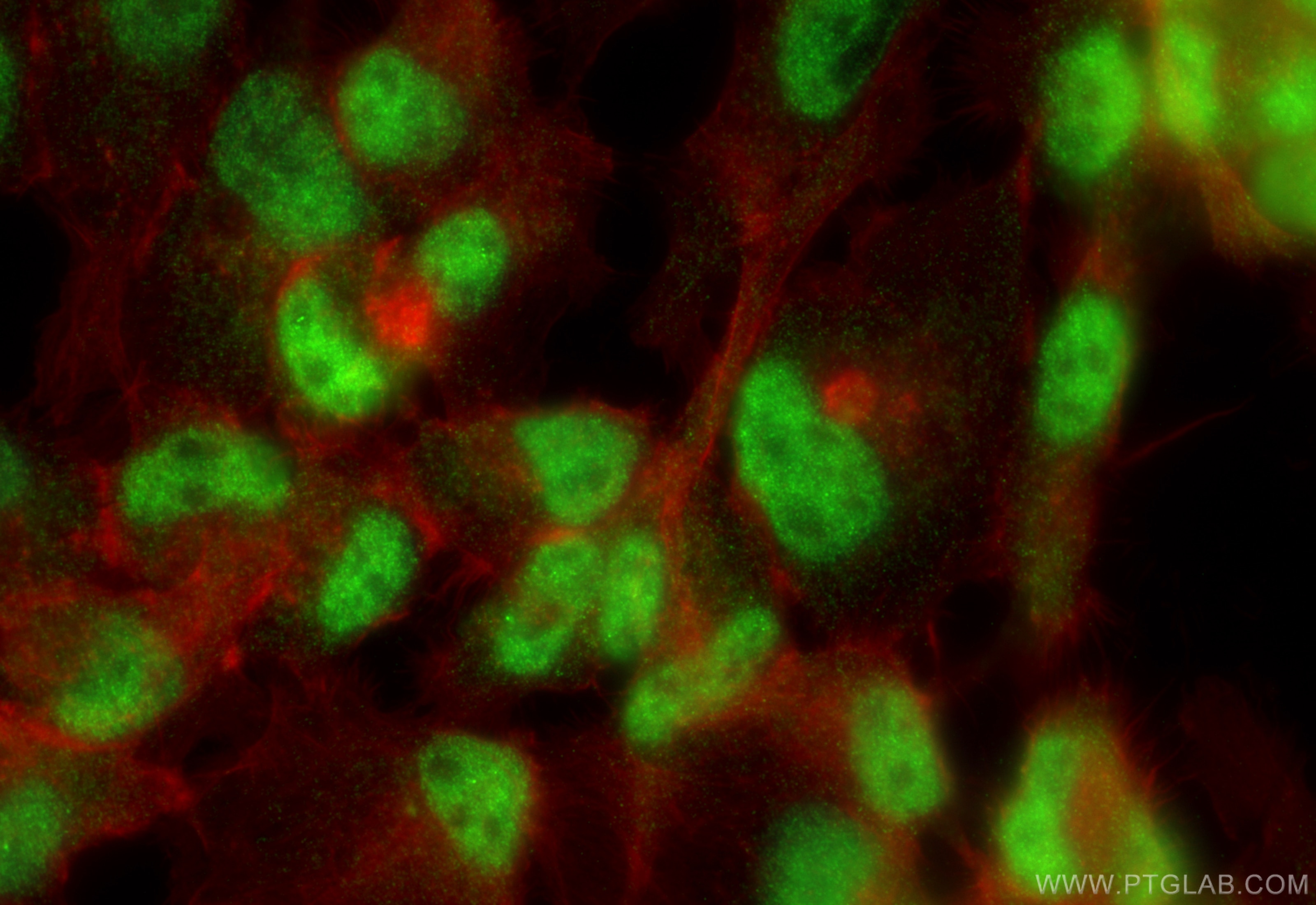 Immunofluorescence (IF) / fluorescent staining of A431 cells using C2orf49 Polyclonal antibody (18272-1-AP)