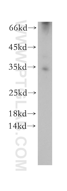 Western Blot (WB) analysis of mouse liver tissue using C2orf49 Polyclonal antibody (18272-1-AP)