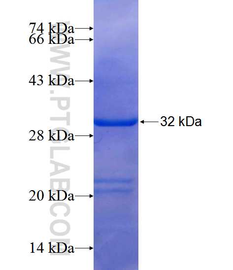 C2orf49 fusion protein Ag12948 SDS-PAGE