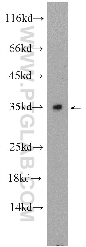 Western Blot (WB) analysis of mouse testis tissue using C2orf51 Polyclonal antibody (25464-1-AP)