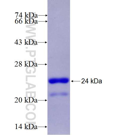 C2orf56 fusion protein Ag27590 SDS-PAGE