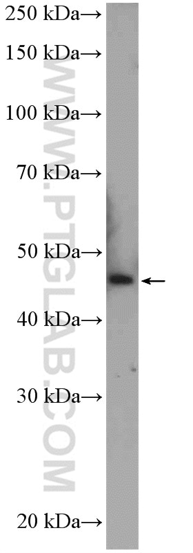 WB analysis of Jurkat using 26145-1-AP