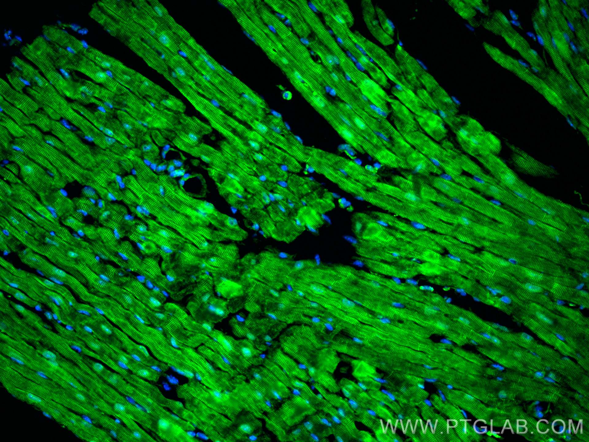 IF Staining of mouse heart using 24751-1-AP