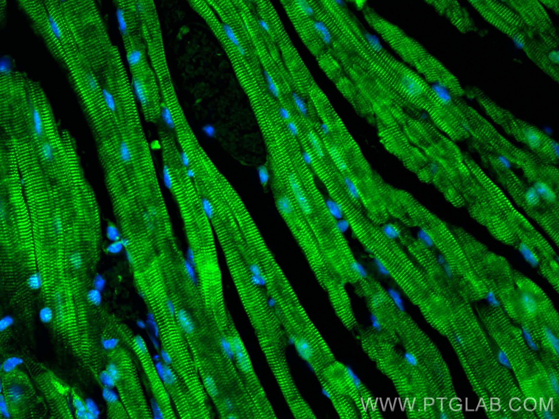 Immunofluorescence (IF) / fluorescent staining of mouse heart tissue using C2orf62 Polyclonal antibody (24751-1-AP)