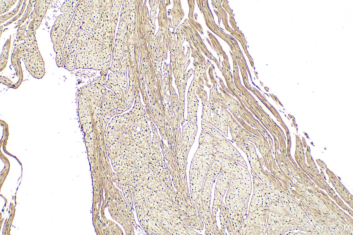 Immunohistochemistry (IHC) staining of mouse heart tissue using C2orf62 Polyclonal antibody (24751-1-AP)