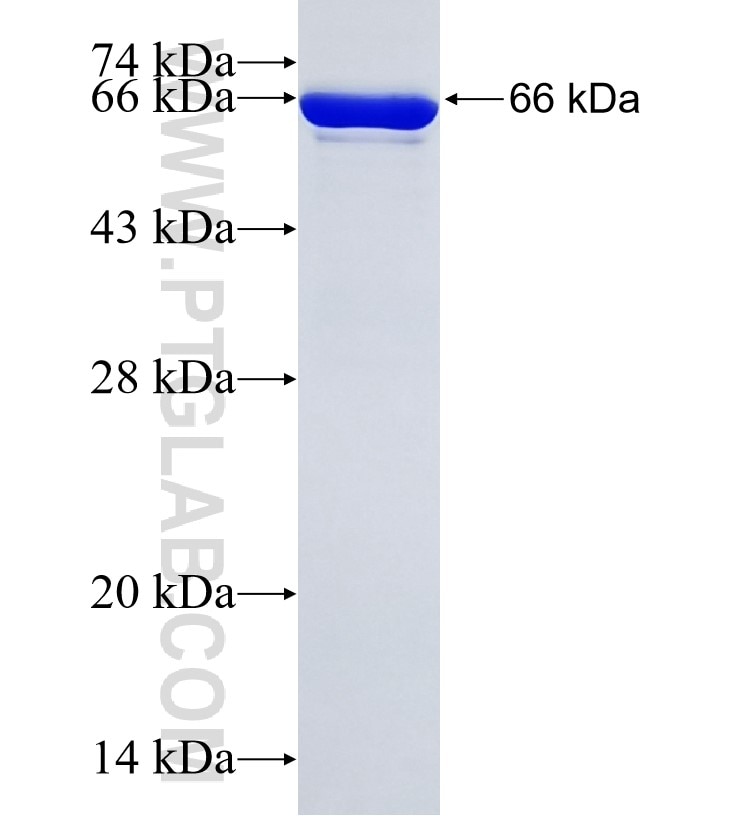 C2orf62 fusion protein Ag20587 SDS-PAGE C2orf62 fusion protein Ag20587 SDS-PAGE