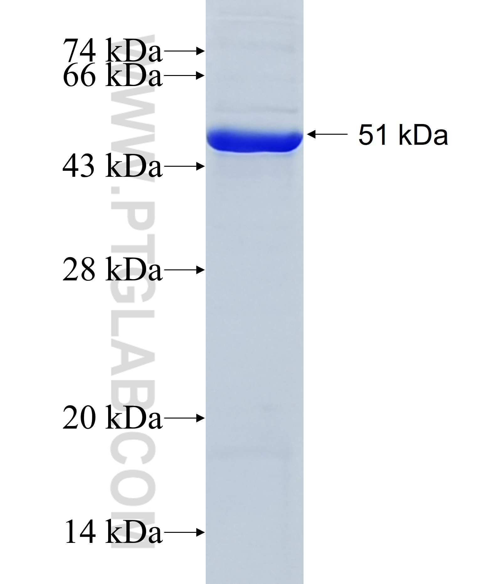 C2orf62 fusion protein Ag20596 SDS-PAGE