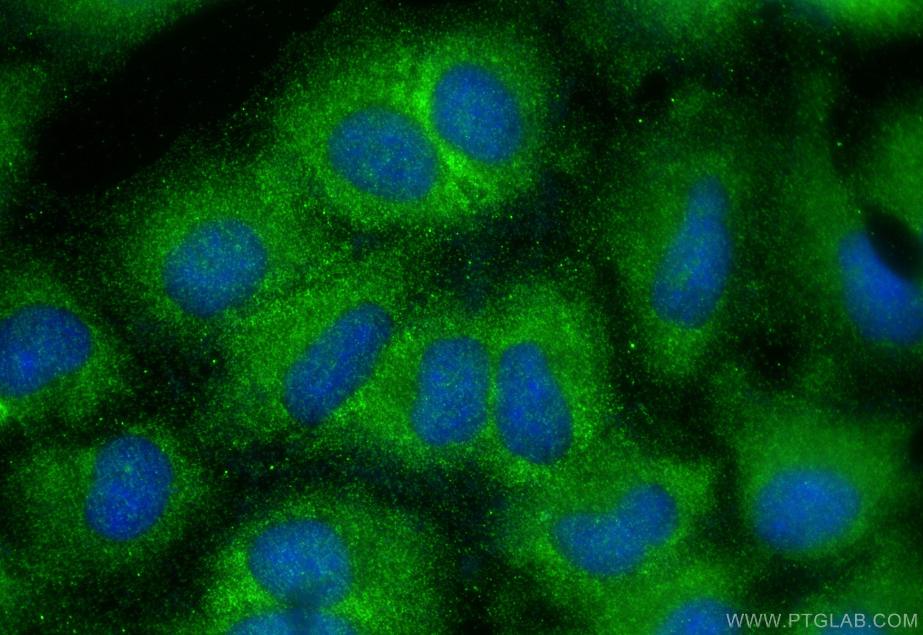Immunofluorescence (IF) / fluorescent staining of A549 cells using C2orf67 Polyclonal antibody (24183-1-AP)