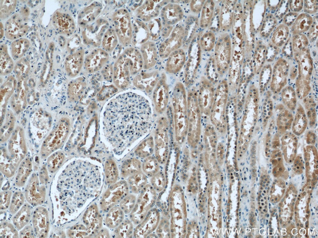 Immunohistochemistry (IHC) staining of human kidney tissue using C2orf67 Polyclonal antibody (24183-1-AP)