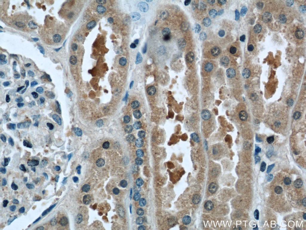 Immunohistochemistry (IHC) staining of human kidney tissue using C2orf67 Polyclonal antibody (24183-1-AP)