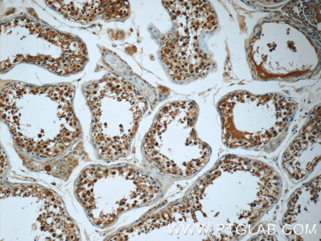 Immunohistochemistry (IHC) staining of human testis tissue using C2orf67 Polyclonal antibody (24183-1-AP)