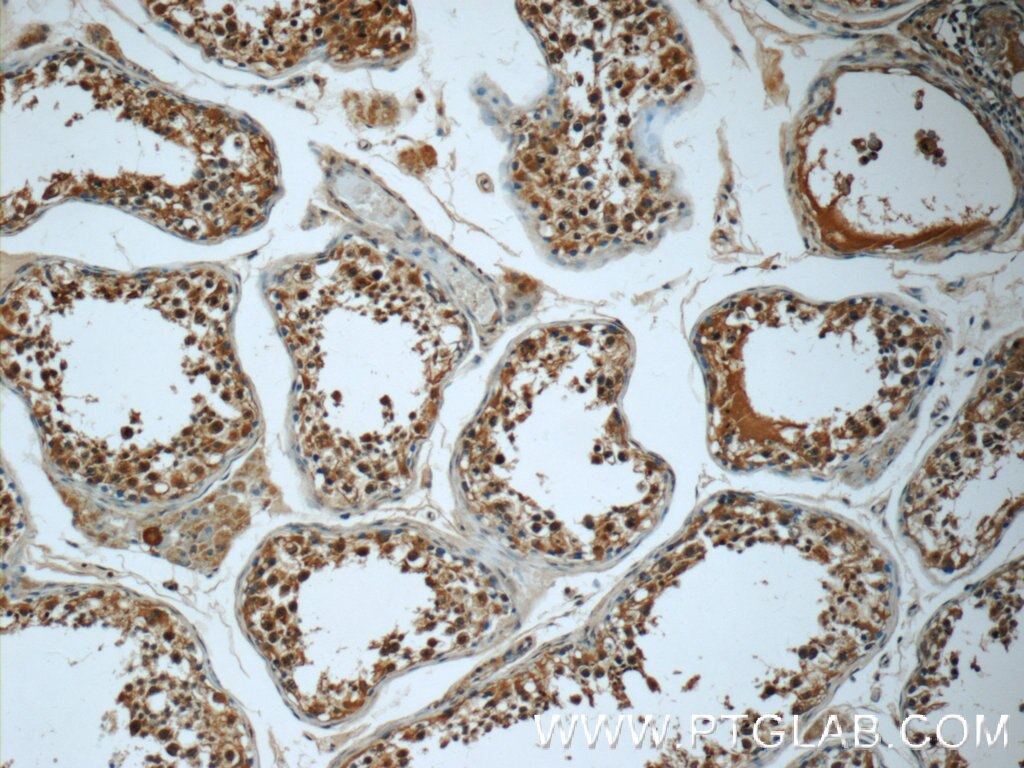 IHC staining of human testis using 24183-1-AP