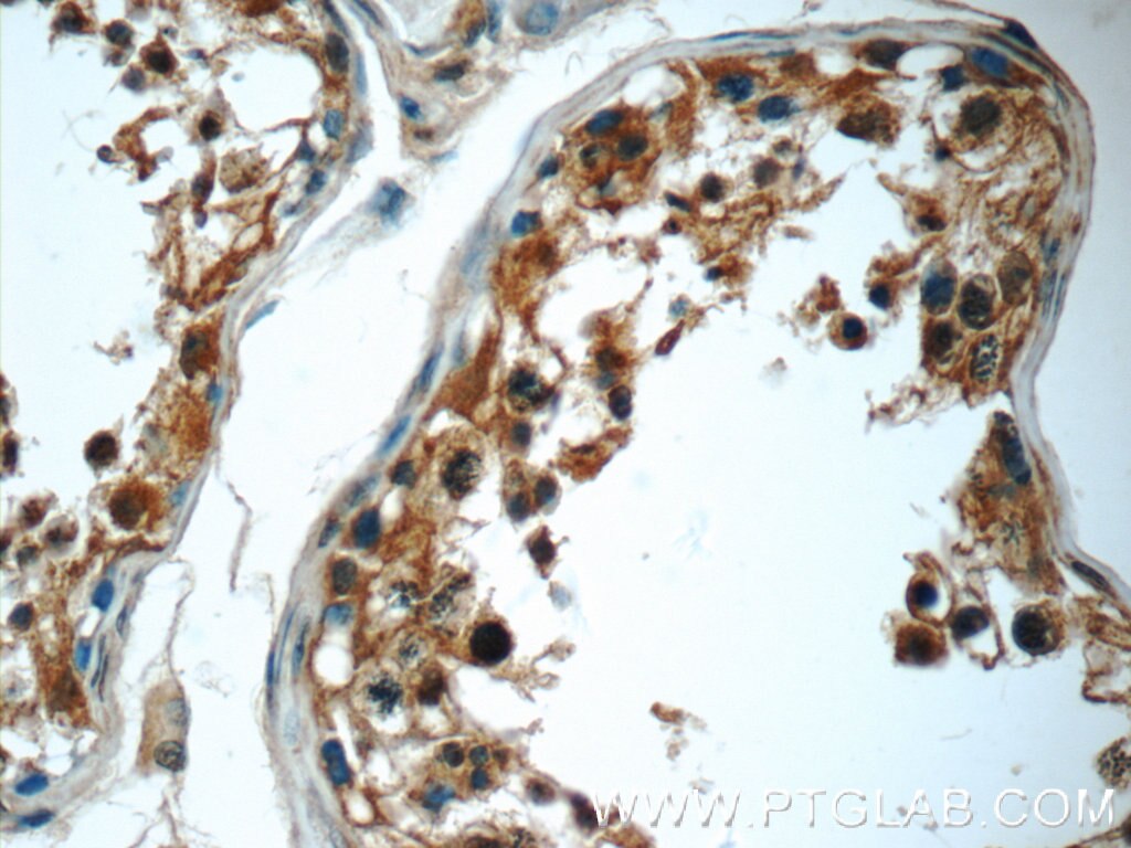 Immunohistochemistry (IHC) staining of human testis tissue using C2orf67 Polyclonal antibody (24183-1-AP)