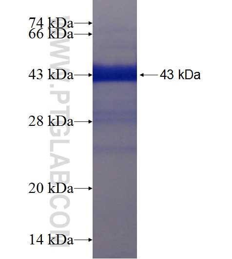 C2orf67 fusion protein Ag21471 SDS-PAGE
