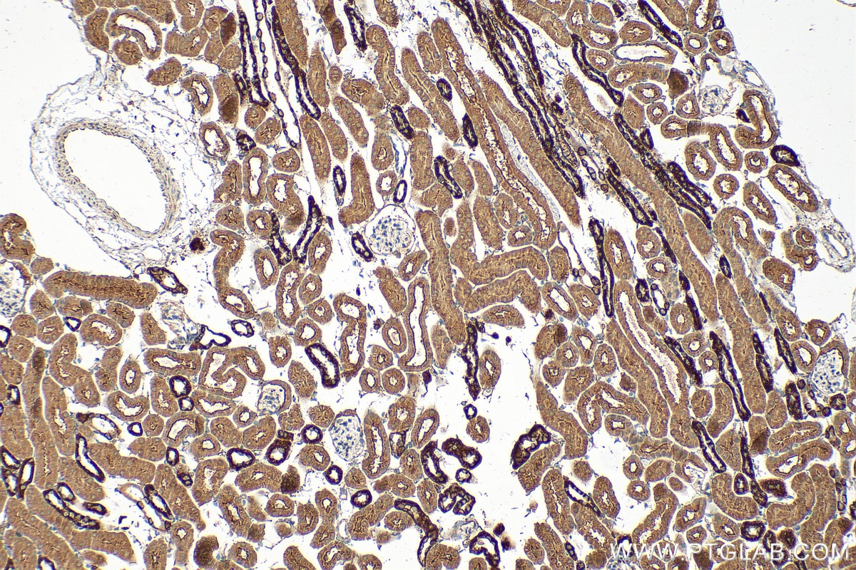Immunohistochemistry (IHC) staining of mouse kidney tissue using C2orf69 Polyclonal antibody (32100-1-AP)