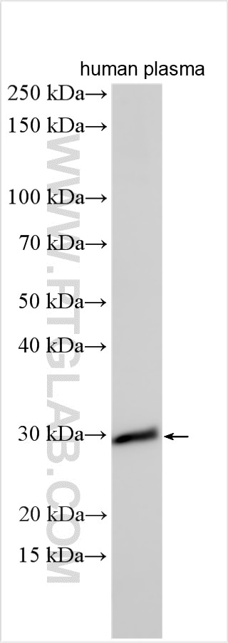 WB analysis using 20616-1-AP