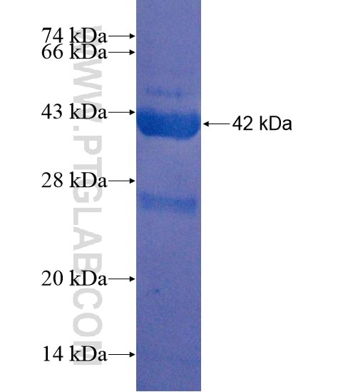 C2orf79 fusion protein Ag22255 SDS-PAGE