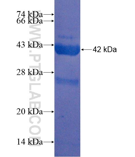 C2orf79 fusion protein Ag22255 SDS-PAGE