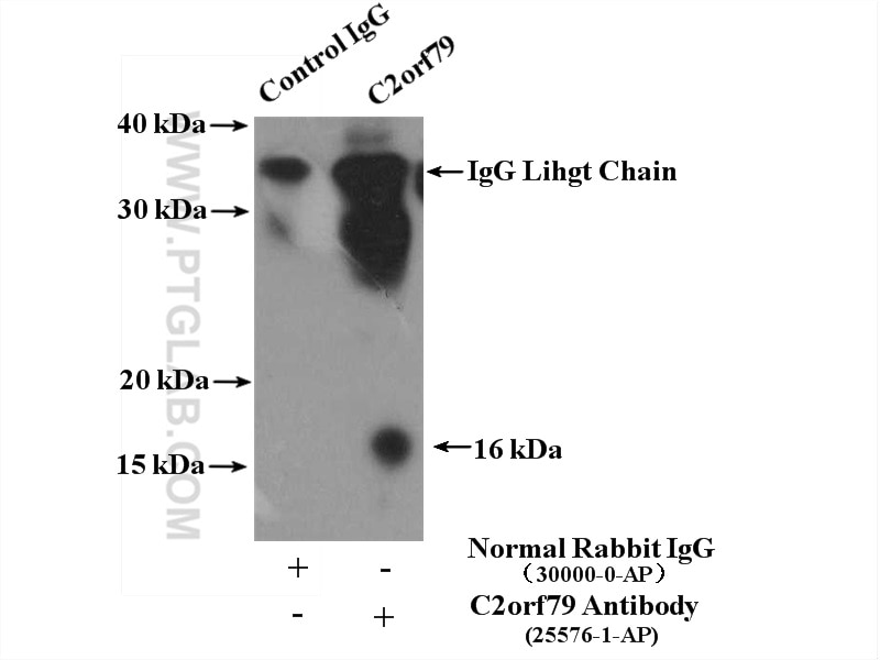 Immunoprecipitation (IP) experiment of COLO 320 cells using C2orf79/PTRHD1 Polyclonal antibody (25576-1-AP)