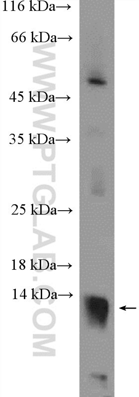 Western Blot (WB) analysis of HepG2 cells using C2orf79/PTRHD1 Polyclonal antibody (25576-1-AP)