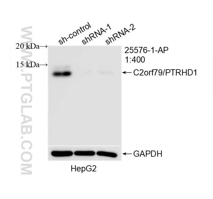 Western Blot (WB) analysis of HepG2 cells using C2orf79/PTRHD1 Polyclonal antibody (25576-1-AP)