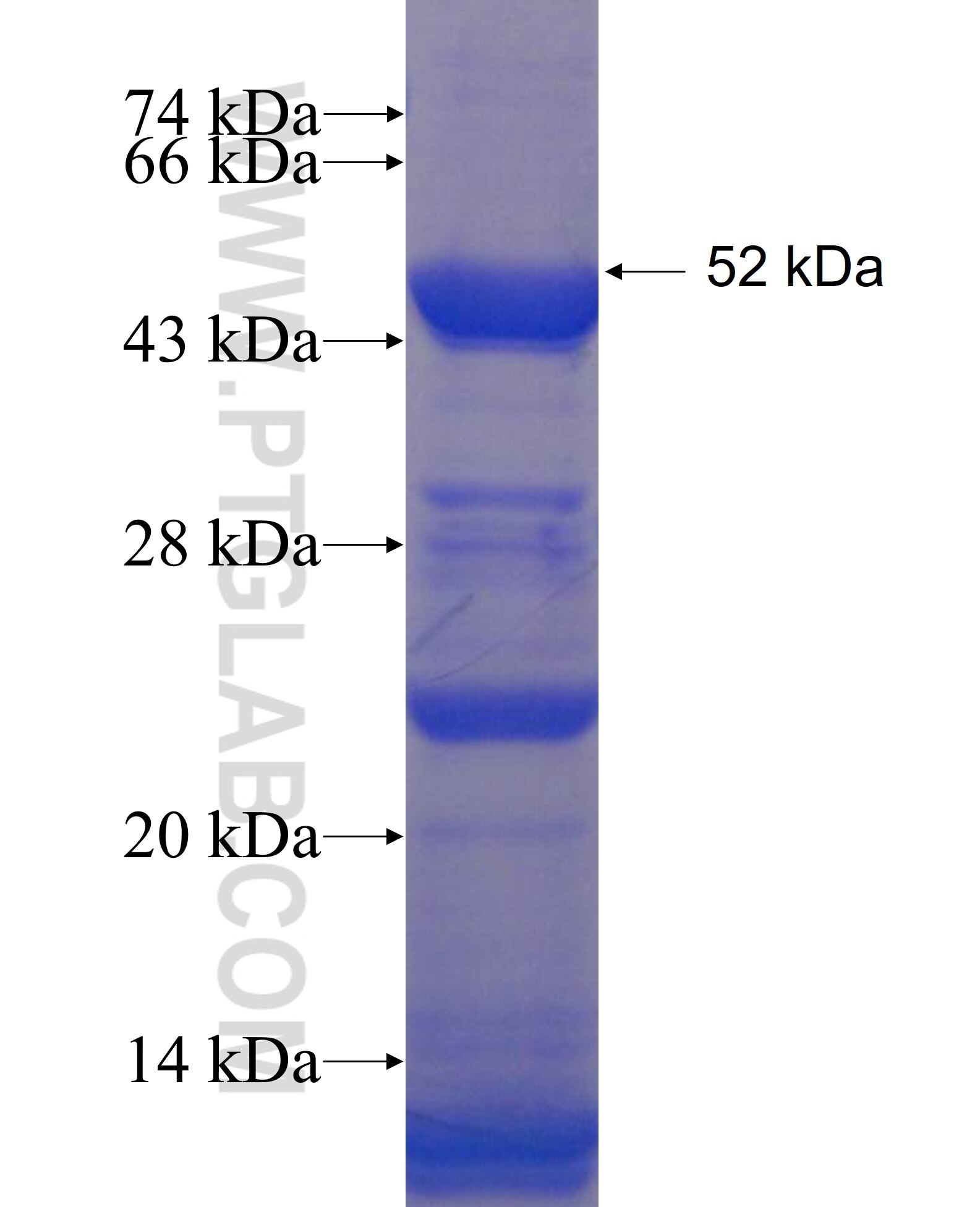 C2orf86 fusion protein Ag22720 SDS-PAGE