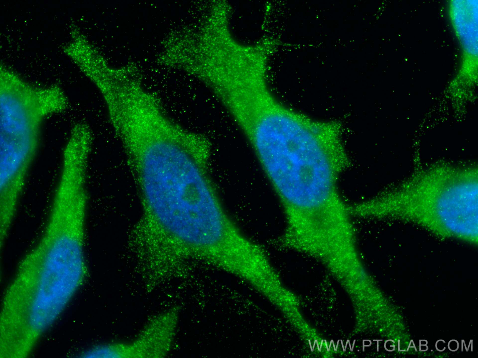 Immunofluorescence (IF) / fluorescent staining of HeLa cells using C3/C3b/C3c Polyclonal antibody (21337-1-AP)