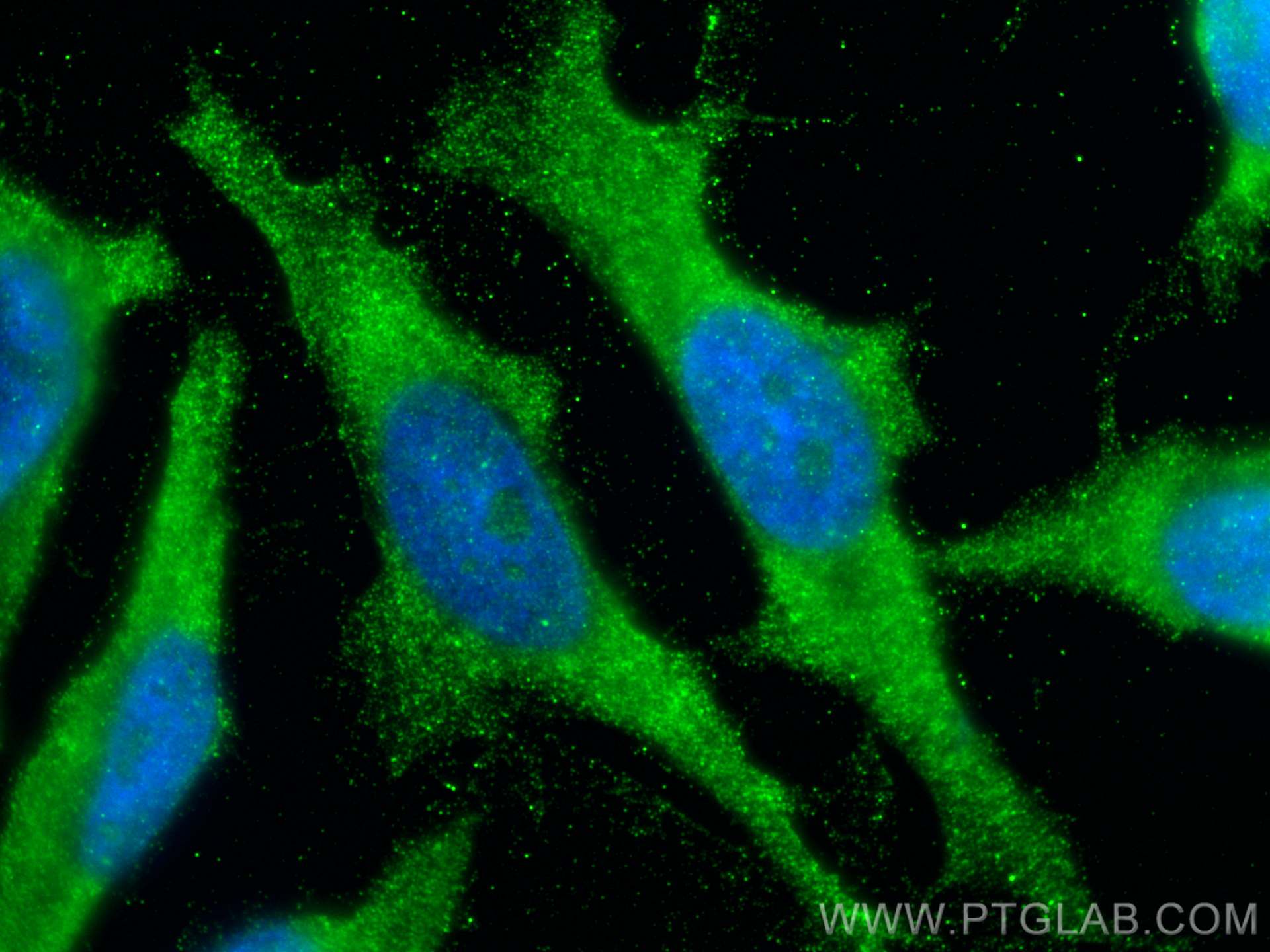 IF Staining of HeLa using 21337-1-AP