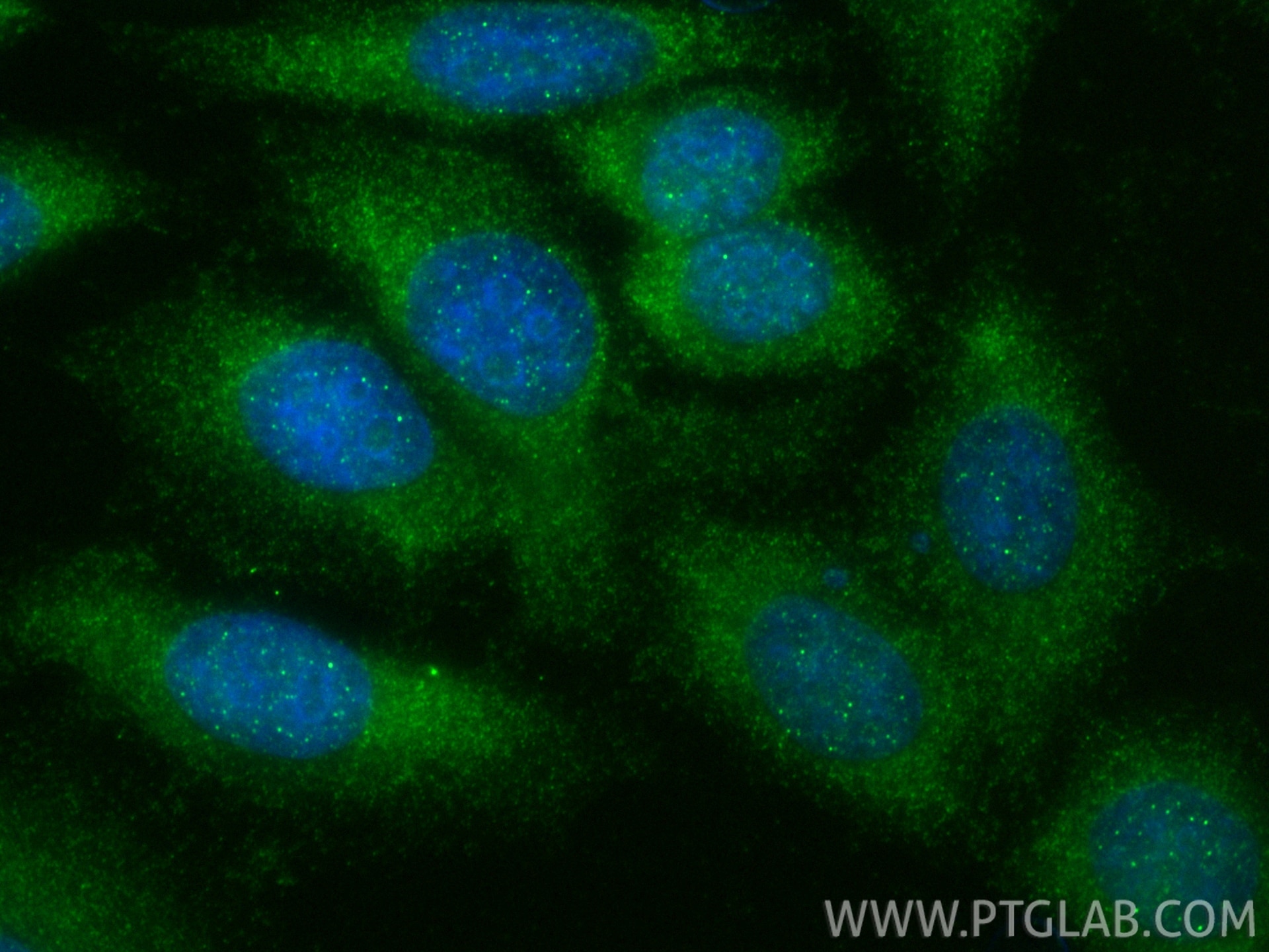 Immunofluorescence (IF) / fluorescent staining of HepG2 cells using C3/C3b/C3c Polyclonal antibody (21337-1-AP)