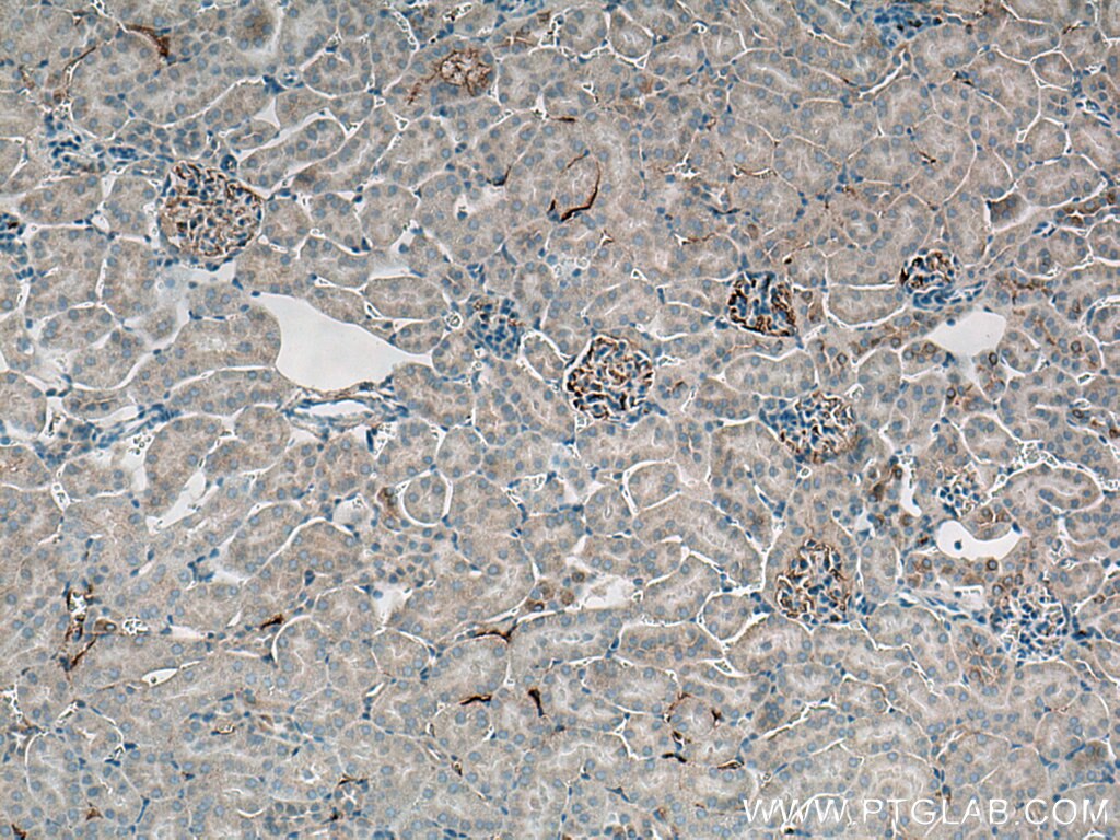 IHC staining of mouse kidney using 21337-1-AP