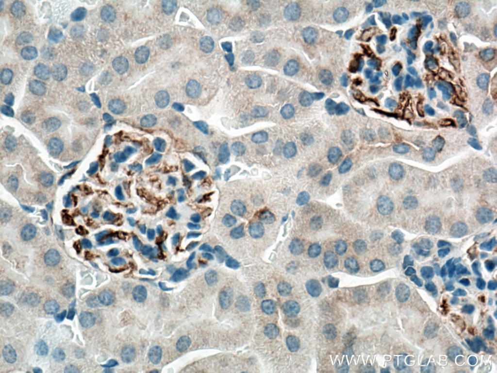 Immunohistochemistry (IHC) staining of mouse kidney tissue using C3/C3b/C3c Polyclonal antibody (21337-1-AP)
