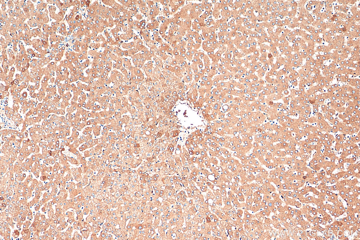 Immunohistochemistry (IHC) staining of human liver tissue using C3/C3b/C3c Polyclonal antibody (21337-1-AP)