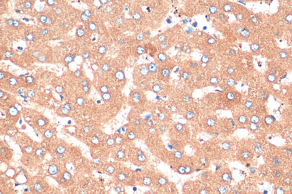 Immunohistochemistry (IHC) staining of human liver tissue using C3/C3b/C3c Polyclonal antibody (21337-1-AP)