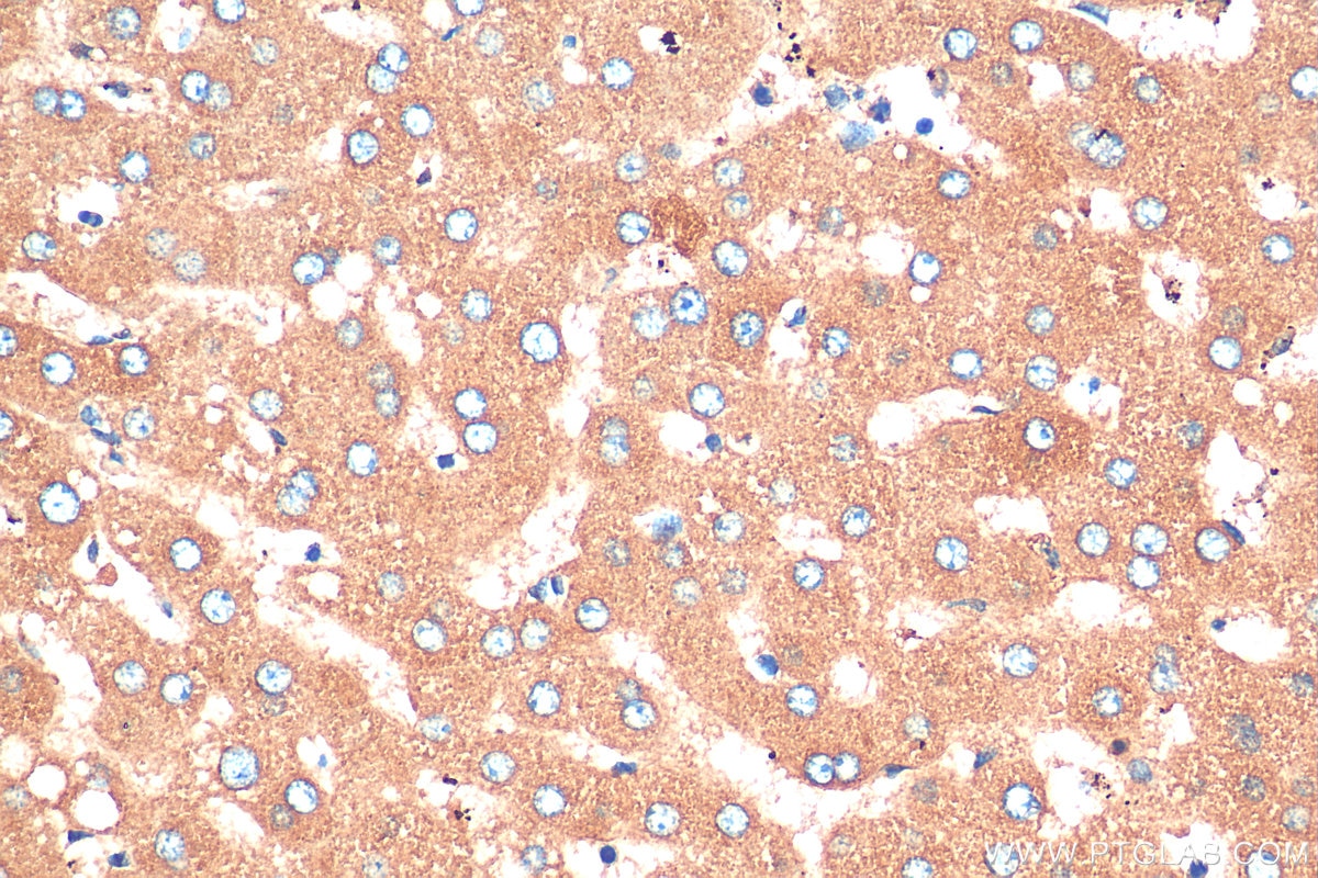 IHC staining of human liver using 21337-1-AP