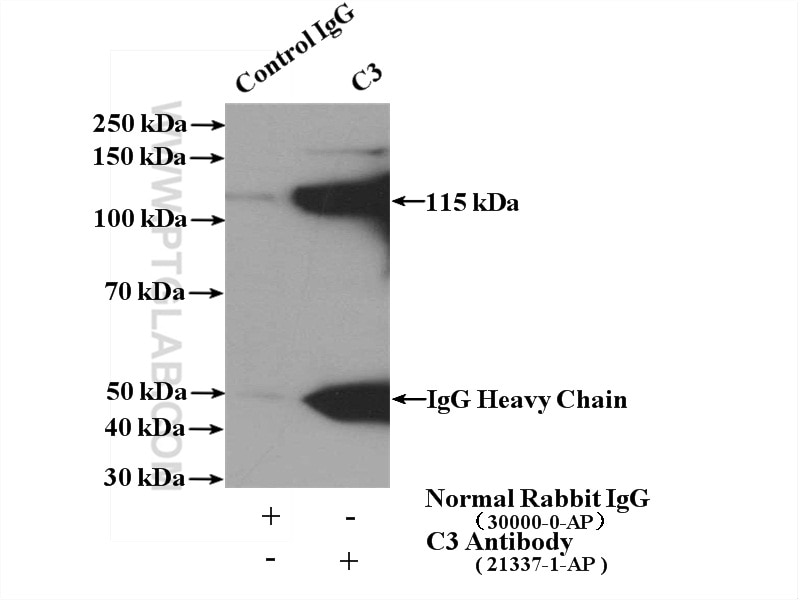 Immunoprecipitation (IP) experiment of human plasma using C3/C3b/C3c Polyclonal antibody (21337-1-AP)