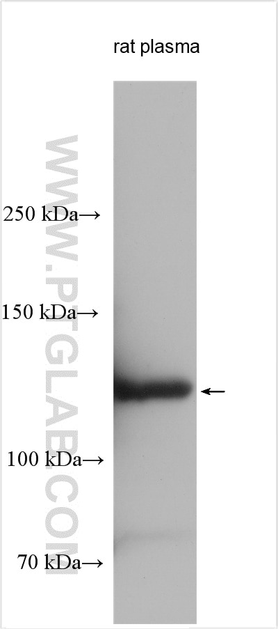 Western Blot (WB) analysis of rat plasma using C3/C3b/C3c Polyclonal antibody (21337-1-AP)