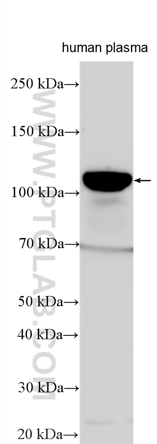 WB analysis using 21337-1-AP Western Blot (WB) analysis of various lysates using C3/C3b/C3c Polyclonal antibody (21337-1-AP)