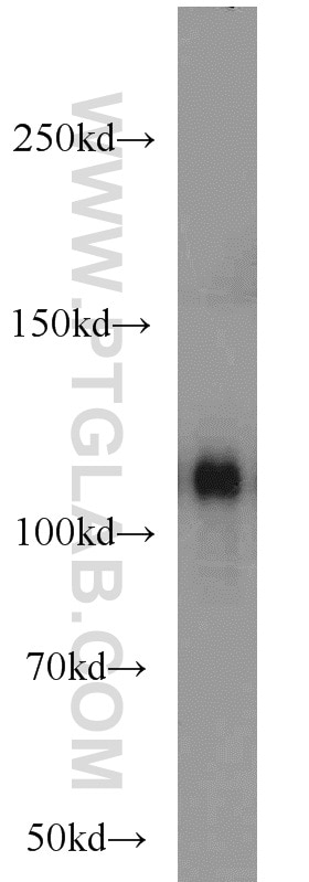 WB analysis of human plasma using 21337-1-AP