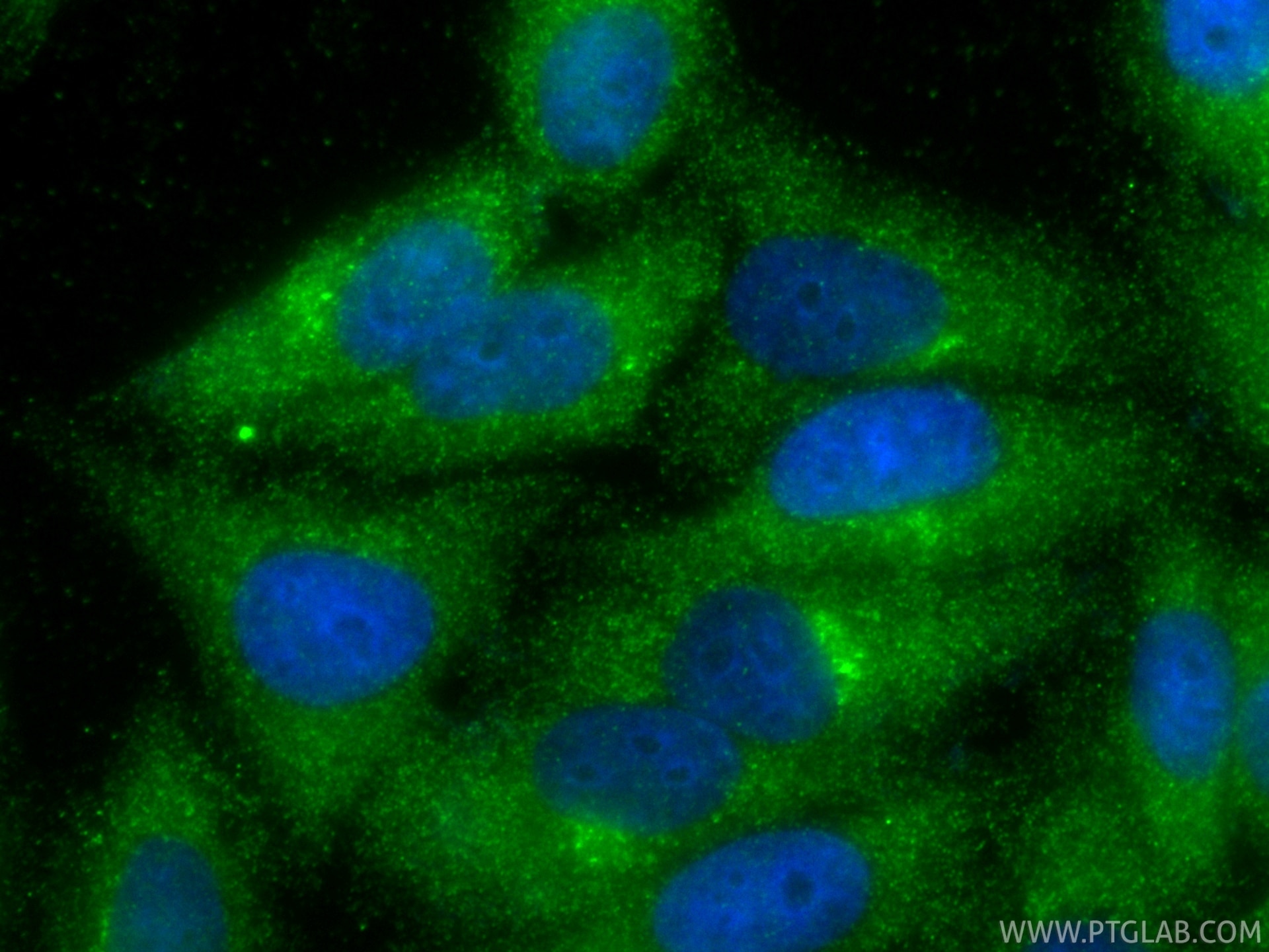 Immunofluorescence (IF) / fluorescent staining of HepG2 cells using C3/C3b/C3c Monoclonal antibody (66157-1-Ig)