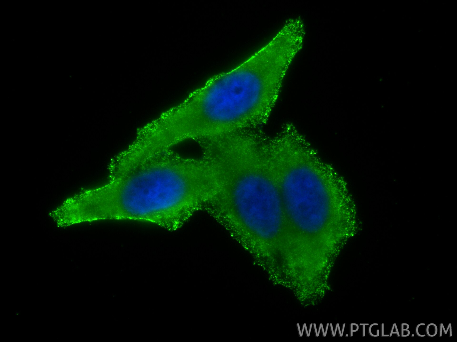 IF Staining of HepG2 using 66157-1-Ig Immunofluorescence (IF) / fluorescent staining of HepG2 cells using C3/C3b/C3c Monoclonal antibody (66157-1-Ig)