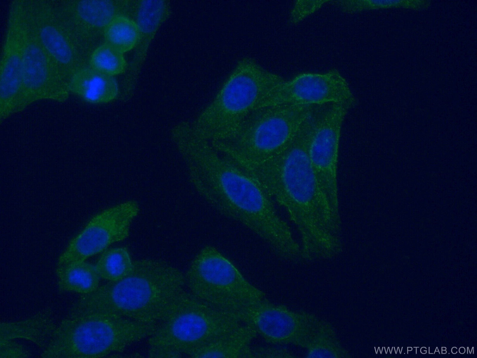 Immunofluorescence (IF) / fluorescent staining of HepG2 cells using C3/C3b/C3c Monoclonal antibody (66157-1-Ig)