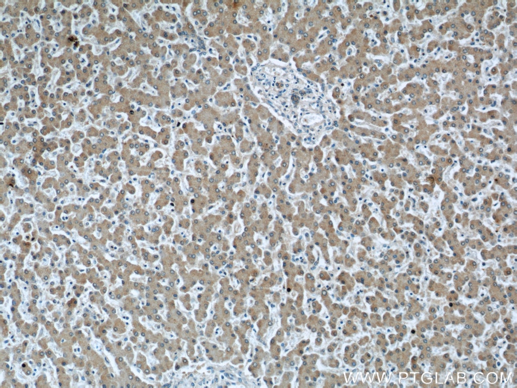 Immunohistochemistry (IHC) staining of human liver tissue using C3/C3b/C3c Monoclonal antibody (66157-1-Ig)